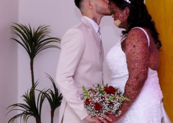 A un hombre le dicen que su amada es ‘repugnante’ por su apariencia, se casa con ella a pesar de que su familia lo llama ‘estúpido’